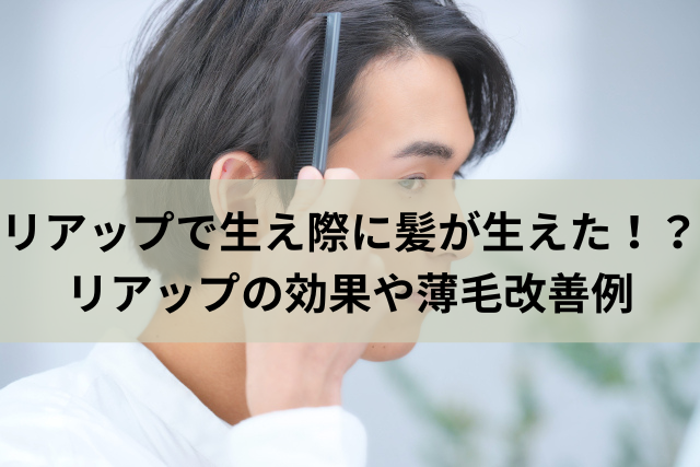 リアップで生え際に髪が生えた！？リアップの効果や薄毛改善例