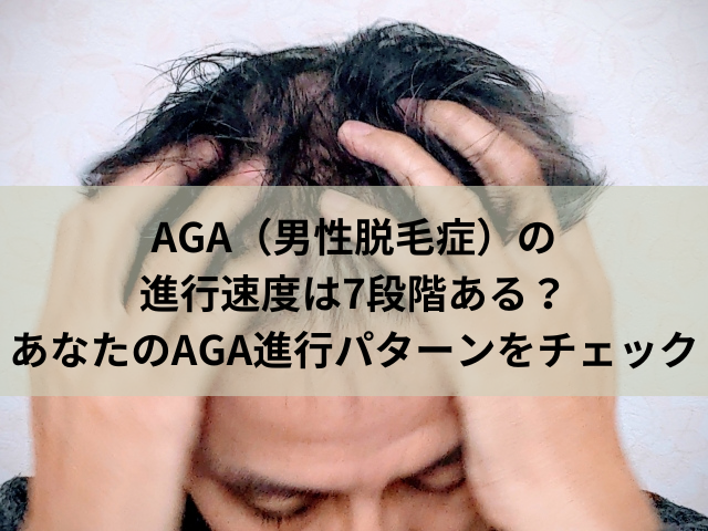 AGA（男性脱毛症）の進行速度は7段階ある？あなたのAGA進行パターンをチェック