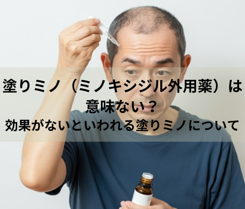 塗りミノ（ミノキシジル外用薬）は意味ない？効果がないといわれる塗りミノについて